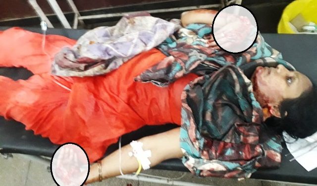 husband attemp murder attack on wife