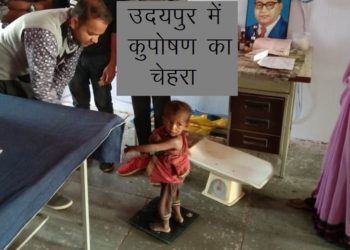 Face of malnutrition in udaipur