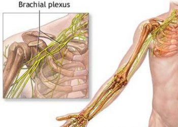 brachial plexus surgery
