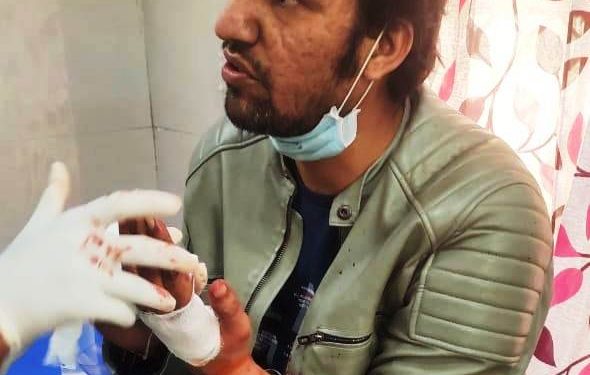 चाइनीज मांझे से बाइक सवार का हाथ कटा