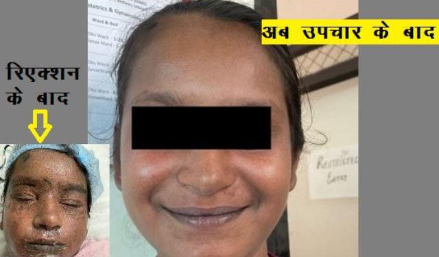 dress syndrome neuro medicine reaction on 13 year old girl - Copy