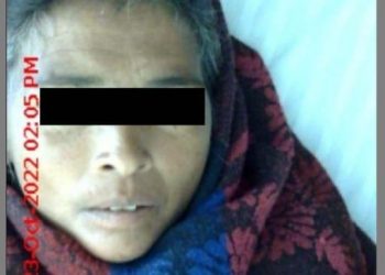 women suffering with rare tropical fever cured in GBH General hospital udaipur