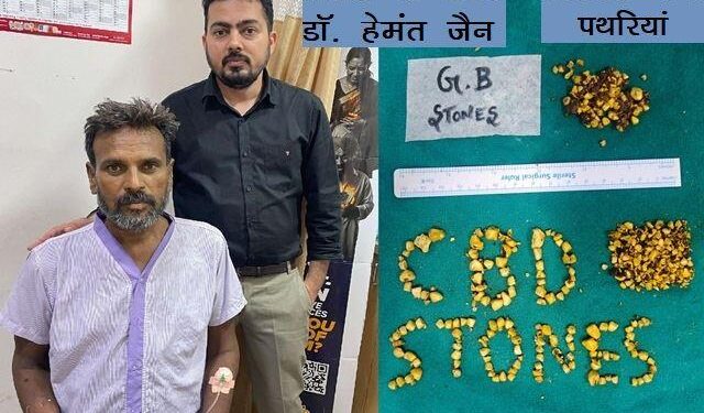 Ananta Hospital doctors team successfully operates and removes more than 250 stones from patient bile duct and liver