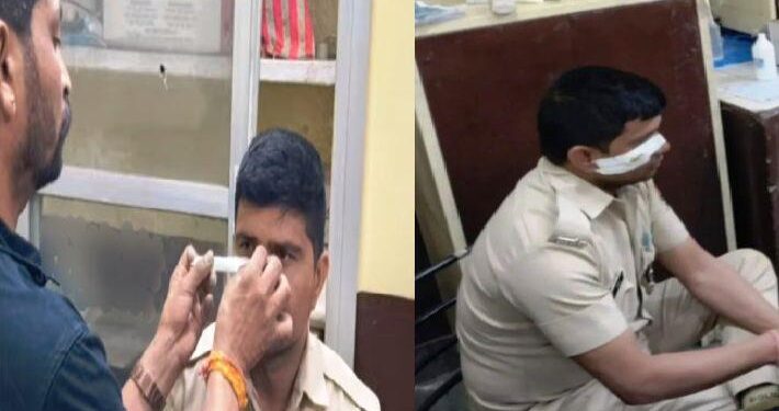 udaipur news | attack on police in baghpura udaipur Criminal activities in Udaipur-Jhadol Highway 58-E