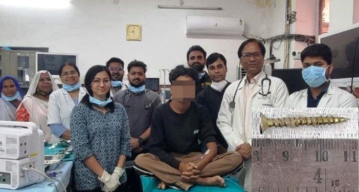 udaipur TB Hospital doctors remove screw using flexible bronchoscopy