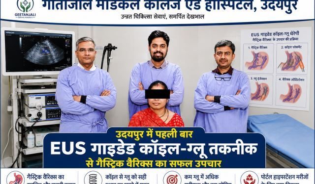 udaipur-first-eus-guided-coil-glue-therapy-gastric-varices-treatment